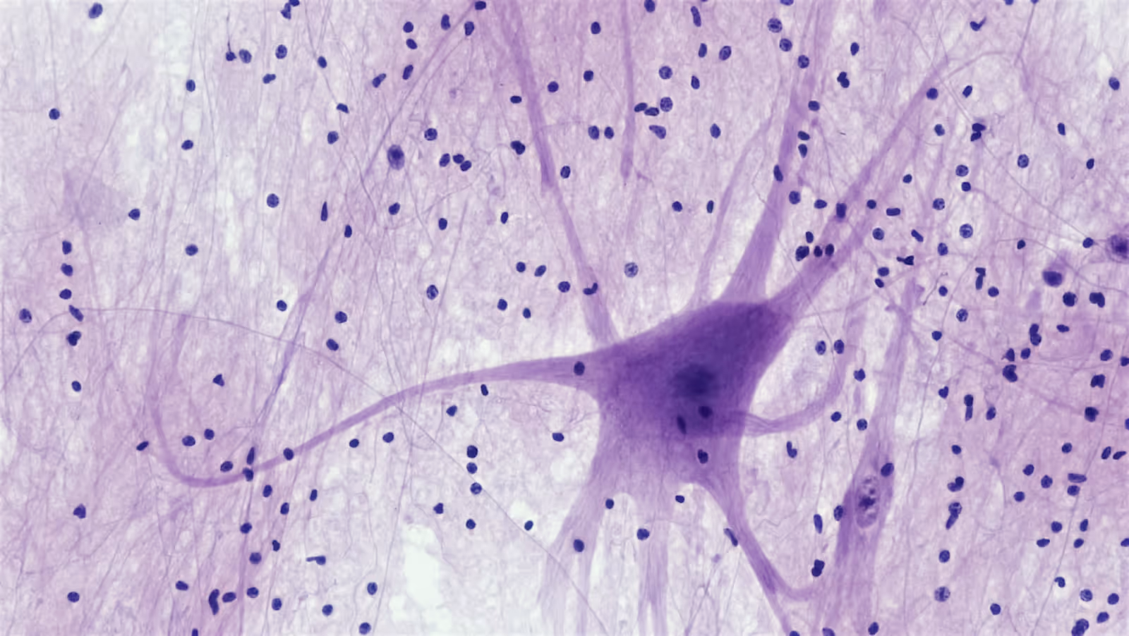 Imagem microscópica em tons de azul e rosa representando tecido nervoso