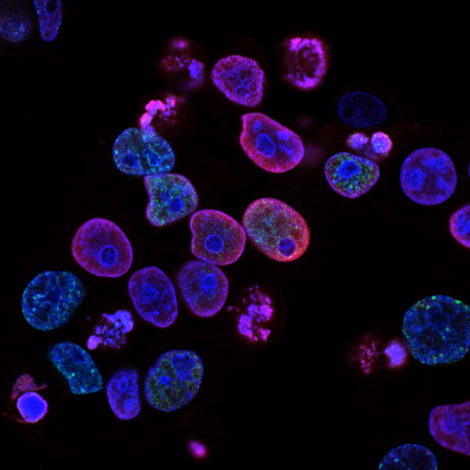 Células cancerosas humanas colorretais vistas ao microscópio com coloração fluorescente em azul, vermelho e verde, imagem de pesquisa do National Cancer Institute