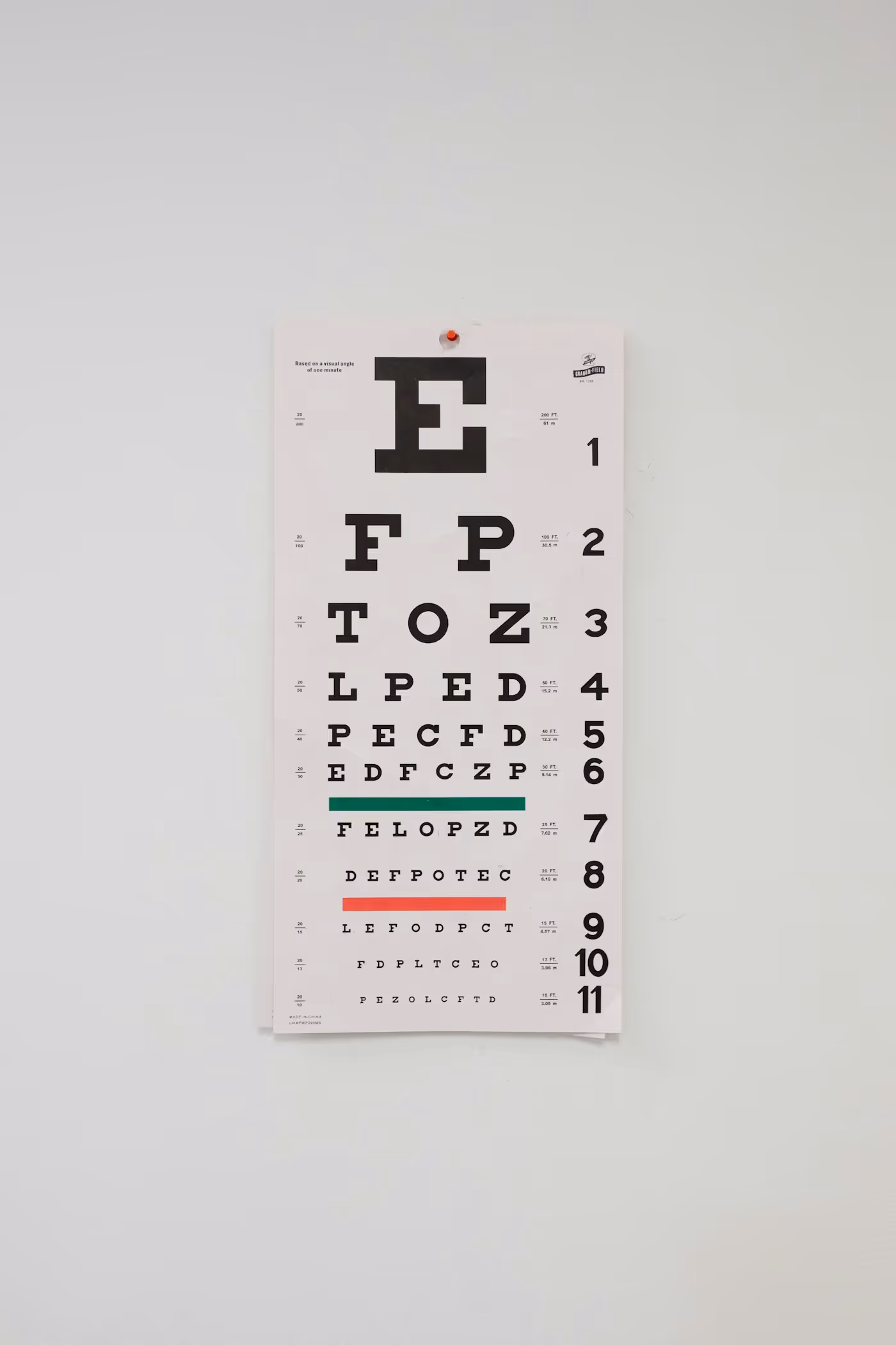 Médico examinando os olhos de paciente com equipamento oftalmológico, exame de fundo de olho