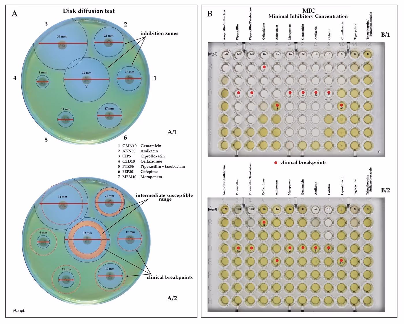 Placa de Petri com teste de susceptibilidade a antibióticos mostrando halos de inibição ao redor de discos de antibiótico